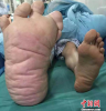 foot.PNG